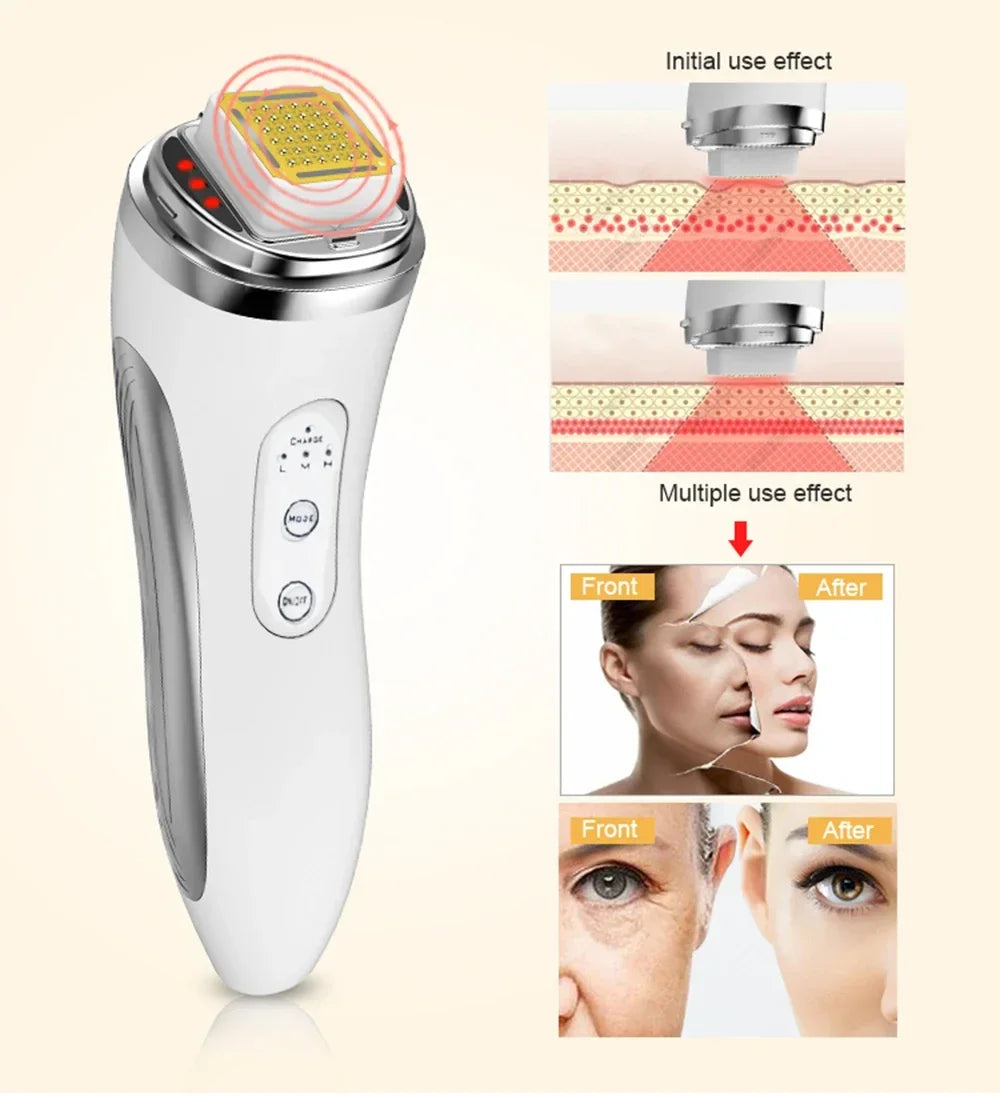 Radio Frequency Facial Lifting Machine Dot Matrix Wrinkle Removal SKin Tightening RF High Frequency Facial Care Massager Device